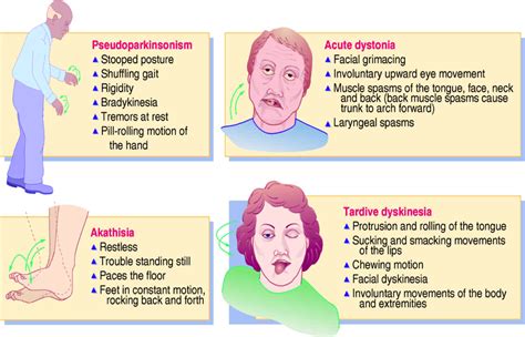 s/s of tardive dyskinesia